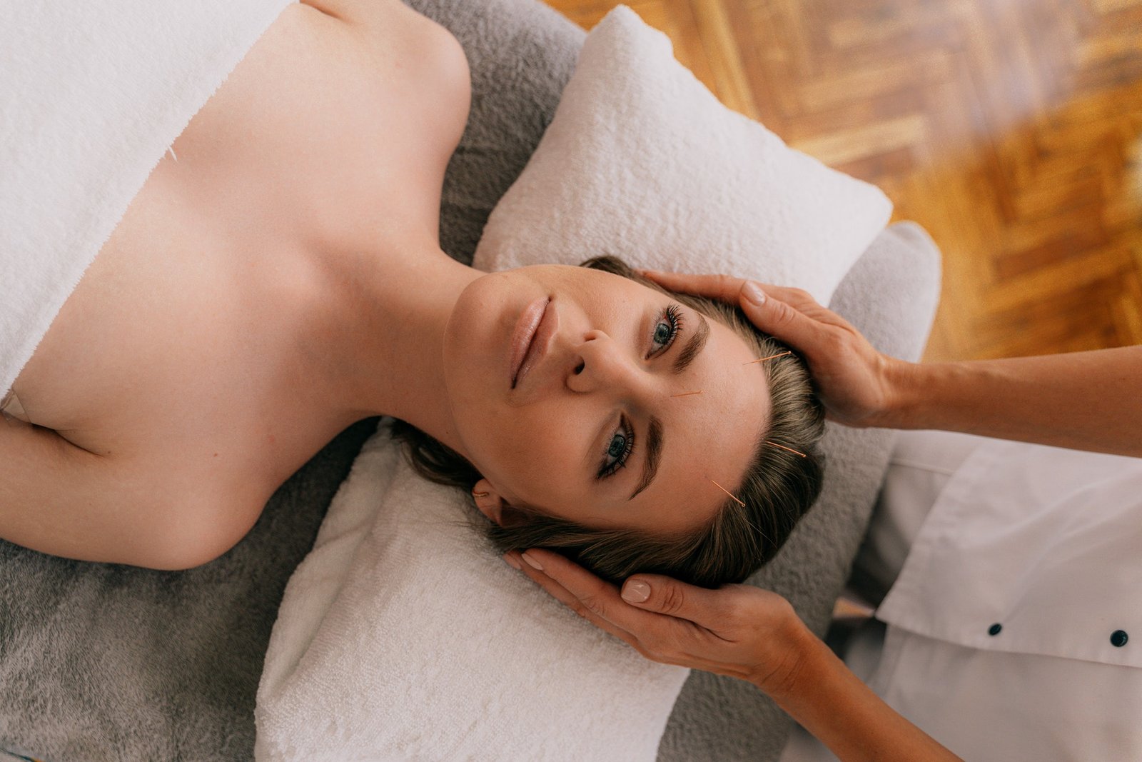 acupuncture points