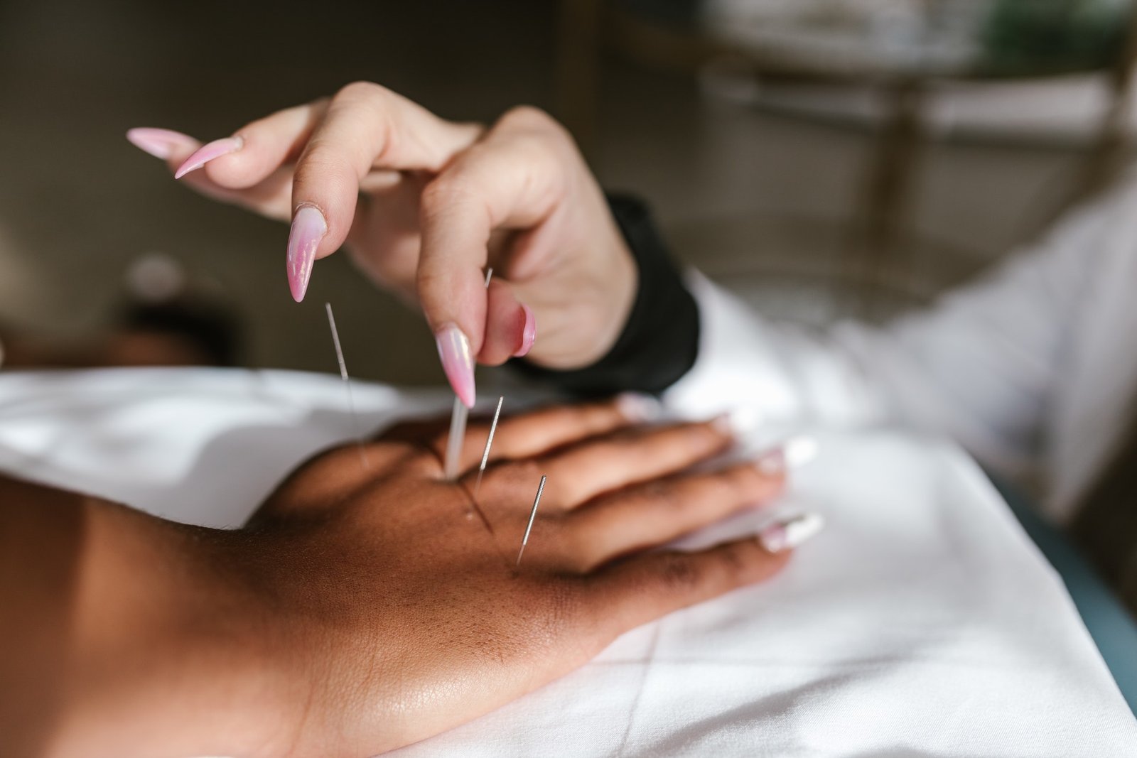 acupuncture benefits