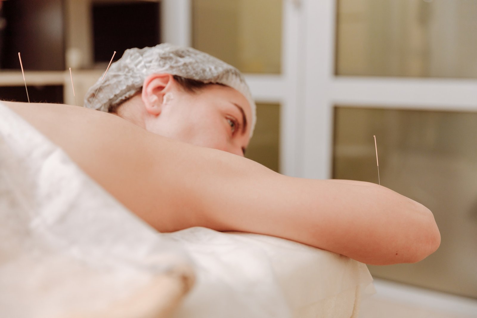 acupuncture